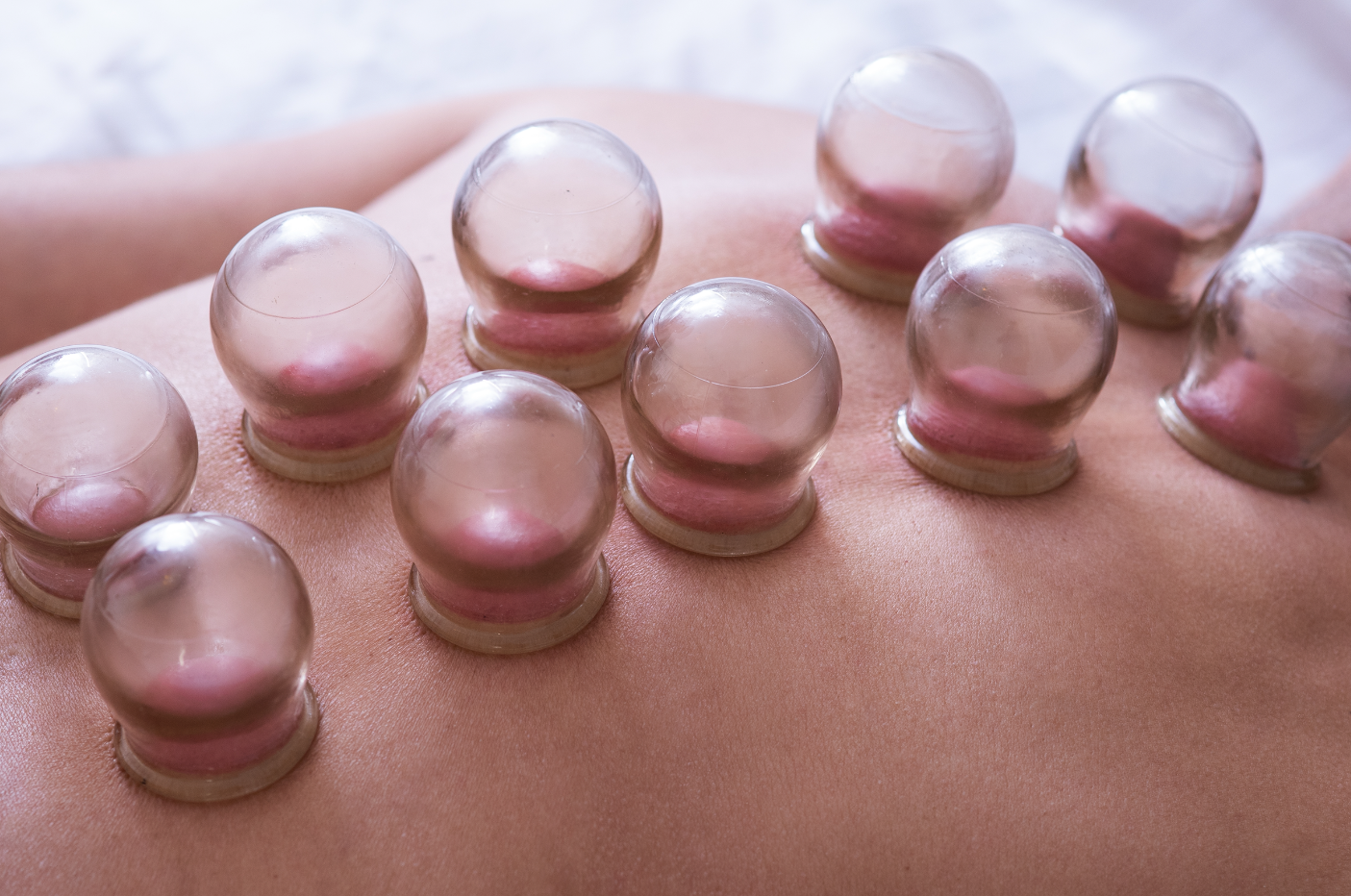 Cupping-Service